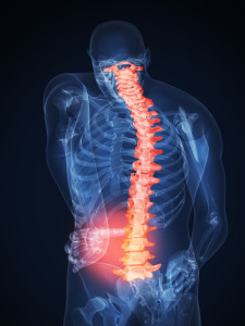 Disability Support for Spinal Cord Injuries